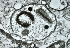 M,28y. | Leishmania - skin M,28y. | Leishmania - skin